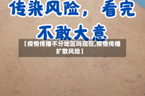 【疫情传播不分地区吗现在,疫情传播扩散风险】