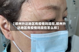 【郑州升达地区有疫情吗现在,郑州升达地区有疫情吗现在怎么样】