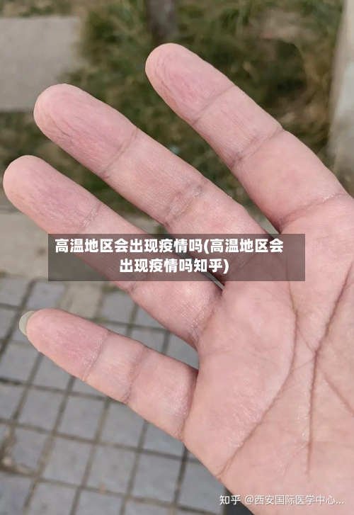 高温地区会出现疫情吗(高温地区会出现疫情吗知乎)-第1张图片