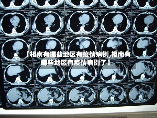 【相南有哪些地区有疫情病例,相南有哪些地区有疫情病例了】-第1张图片
