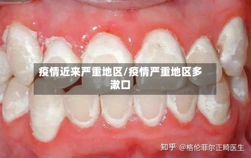 疫情近来严重地区/疫情严重地区多漱口-第1张图片
